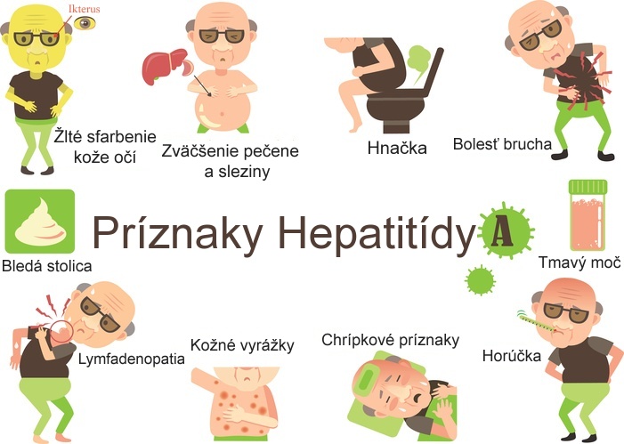 Tieto príznaky môžu sprevádzať hepatitídu typu A Obrázok znázorňuje príznaky pri hepatitída typu A