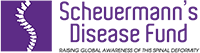 Scheuermannova choroba